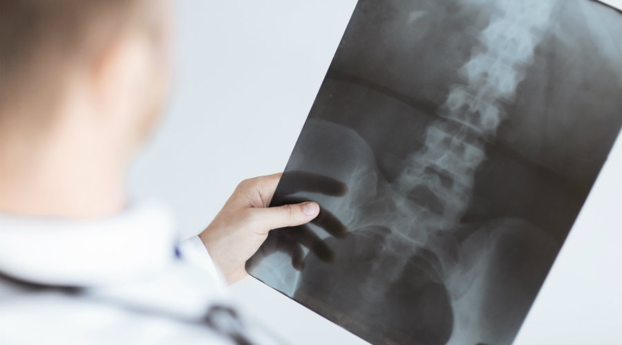 Slips, Trips and Falls: The Aftereffects