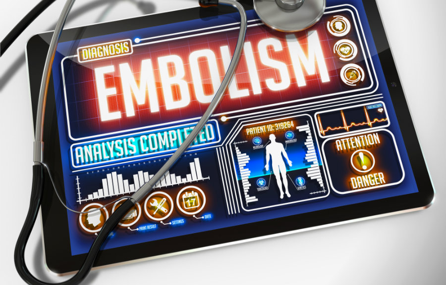 Missouri IVC Filter Wrongful Death Lawsuit Against C.R. Bard