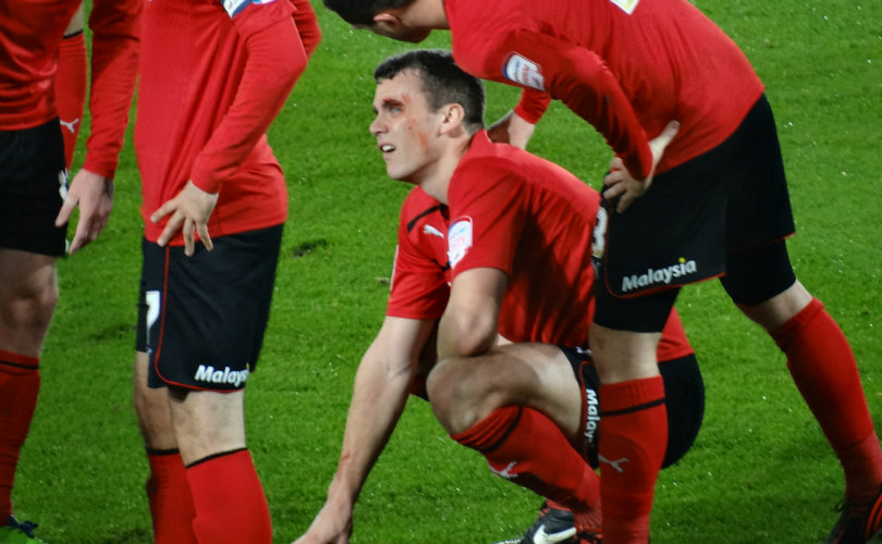 What is a Concussion?