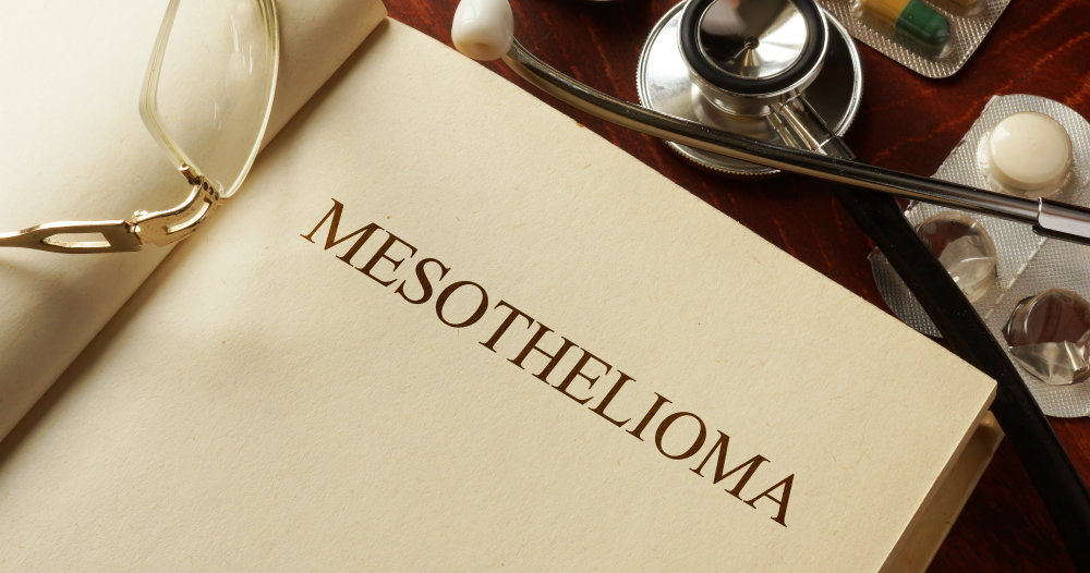 $80 Million in Punitive Damages Against J&J in Asbestos Talc Case