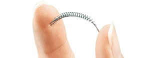 Essure birth control device