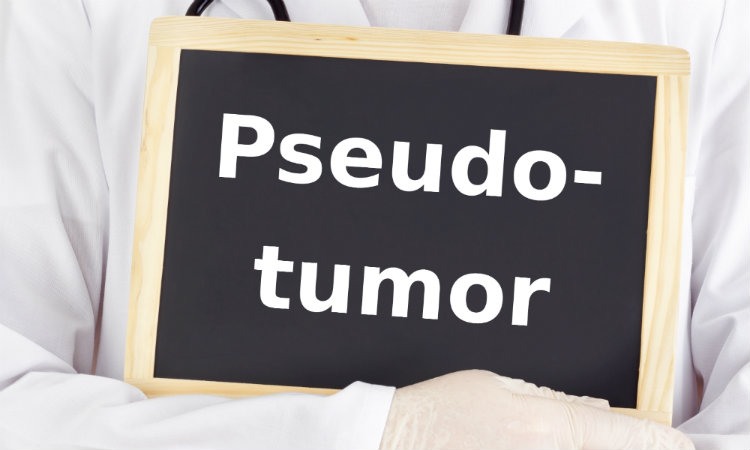 Pseudotumors: Hip Replacement Complication