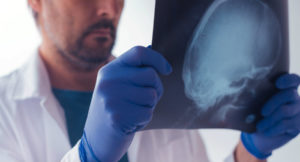 Catastrophic Injury serious injury life threatening injury