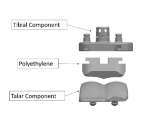 Exactech ankle replacement product recall