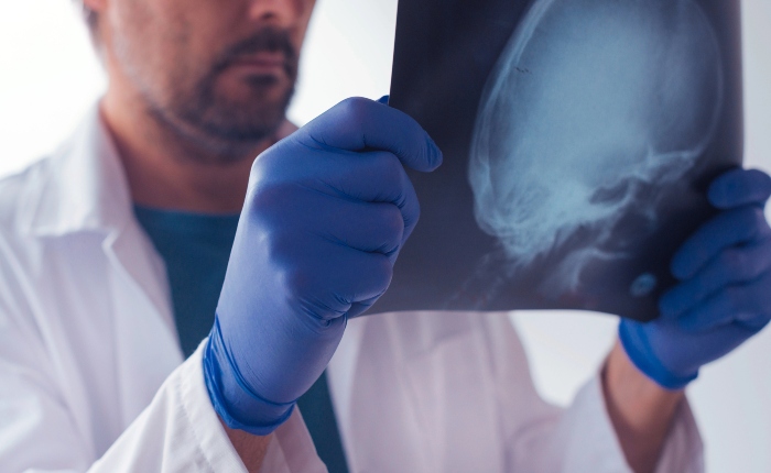 Have You Suffered a Traumatic Brain Injury?